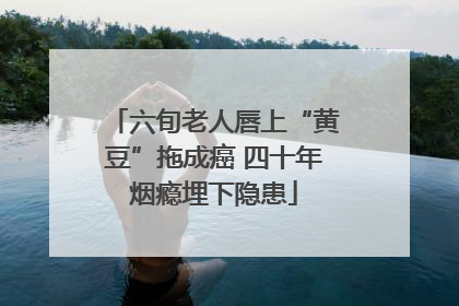 六旬老人唇上“黄豆”拖成癌 四十年烟瘾埋下隐患
