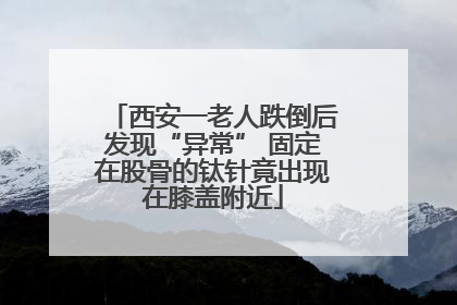 西安一老人跌倒后发现“异常” 固定在股骨的钛针竟出现在膝盖附近
